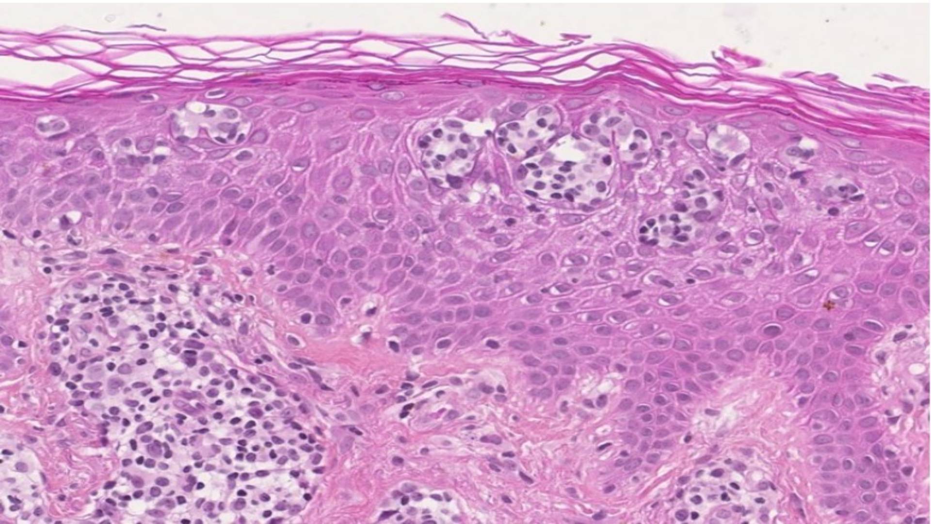 Image-histo2