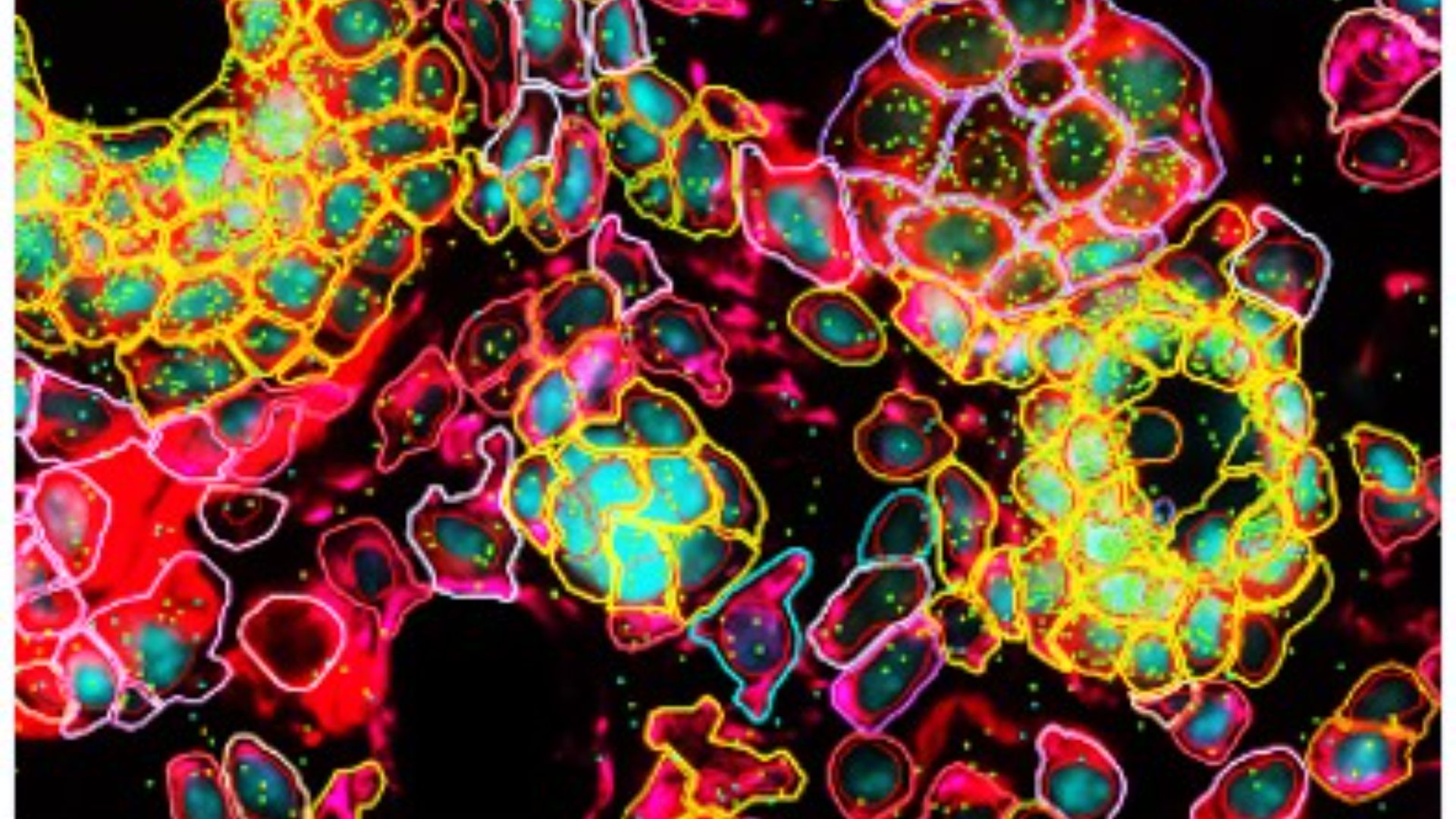 Skin cells